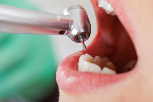 Best Pediatric Emergency Dentist in Bethel Acres, OK